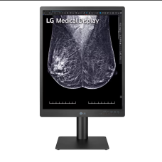 MONITOR DE DIAGNOSTICO 21